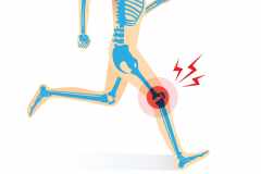 ランナー膝、足裏の痛み、捻挫…ランニングで起こりやすいケガと予防対策