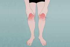 膝の痛みを予防する筋トレ＆ストレッチ。前もも、裏もも、ふくらはぎの筋肉を鍛える