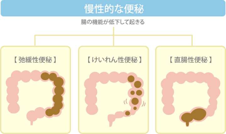 毎日便が出ると痩せる、便秘だと太る?排便回数とダイエットの関係性 | 健康 ×スポーツ『MELOS』