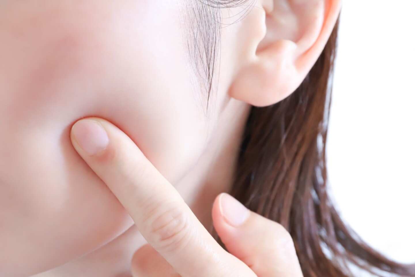 若くても肝斑ができやすい人の特徴。シミとの見分け方、ケア方法を皮膚科医に聞いた