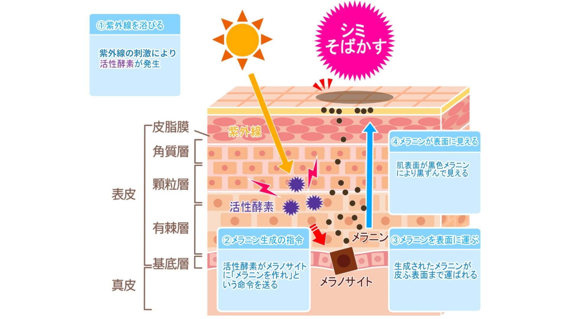 紫外線ダメージ